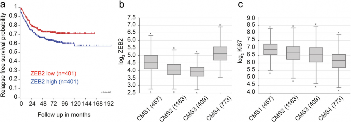 Fig. 5 Higher ZEB2 expression is linked to CMS4 and poor prognosis in colorectal tumors