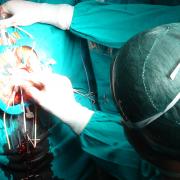 operazione
